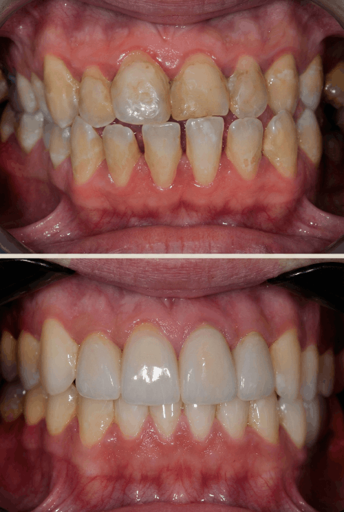 dokmeti_unwatermarked_Gemini_Generated_Image_8i3prf8i3prf8i3p