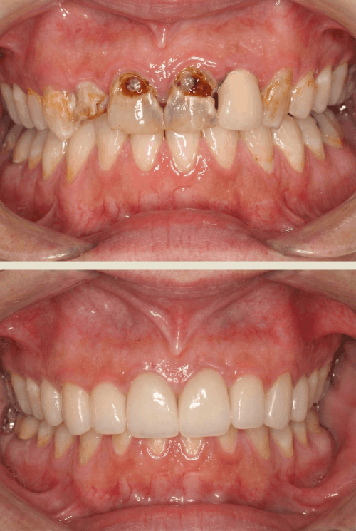 dokmeti_unwatermarked_Gemini_Generated_Image_8ybrd38ybrd38ybr