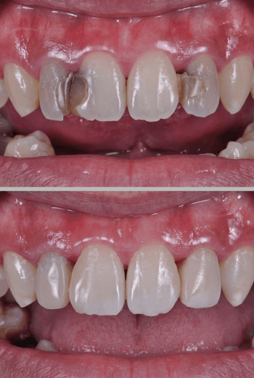 dokmeti_unwatermarked_Gemini_Generated_Image_8z7k878z7k878z7k