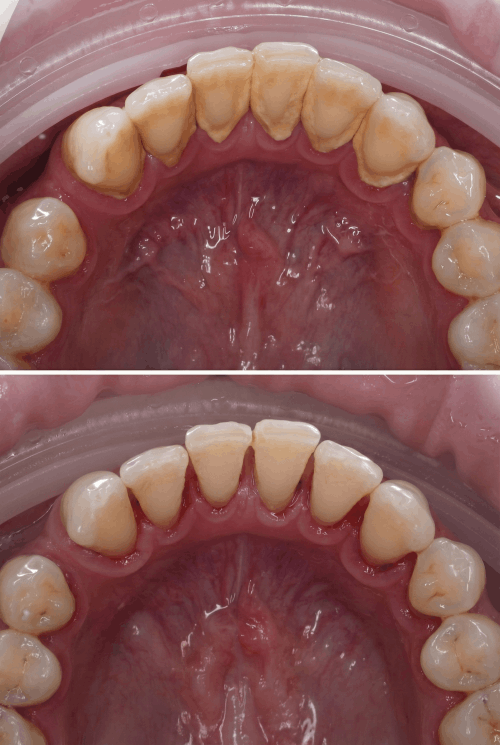 dokmeti_unwatermarked_Gemini_Generated_Image_9577lf9577lf9577