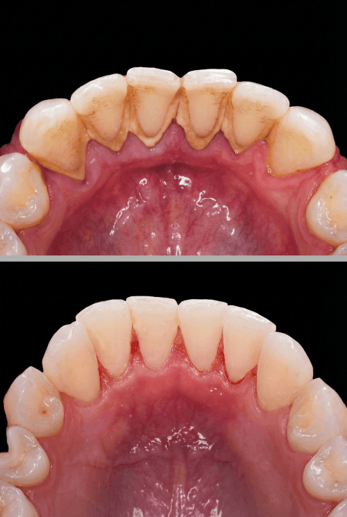 dokmeti_unwatermarked_Gemini_Generated_Image_el3nd6el3nd6el3n