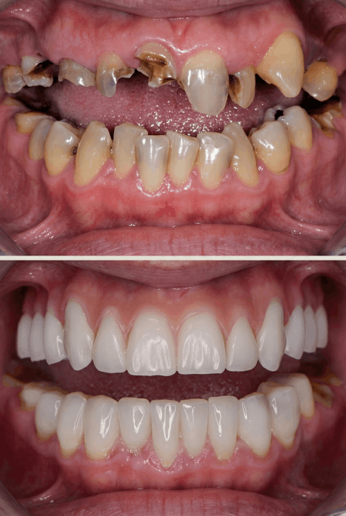 dokmeti_unwatermarked_Gemini_Generated_Image_hvo6v7hvo6v7hvo6