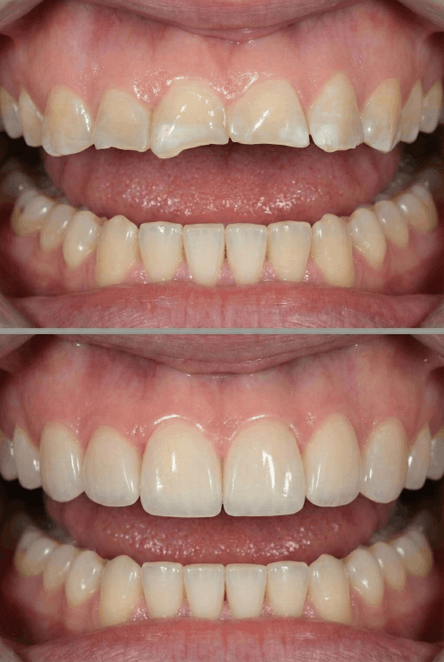 dokmeti_unwatermarked_Gemini_Generated_Image_psc091psc091psc0