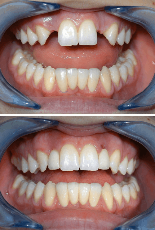 dokmeti_unwatermarked_Gemini_Generated_Image_qmrcc0qmrcc0qmrc