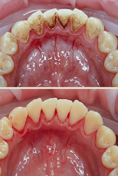 dokmeti_unwatermarked_Gemini_Generated_Image_tlqc89tlqc89tlqc